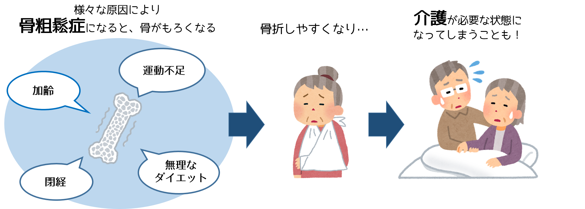 骨粗鬆症について