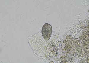 コレプスの写真