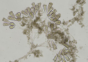 浄化センターの微生物１